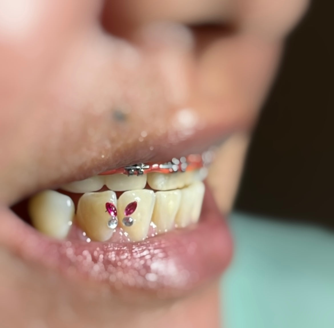 Tooth Gems 💎