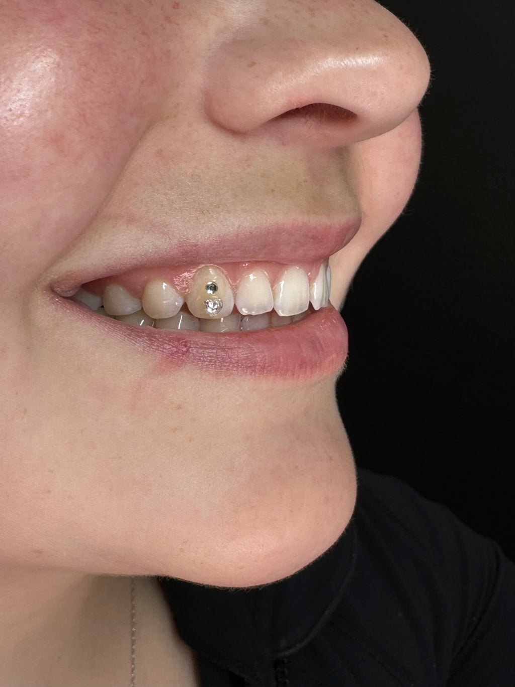 Tooth Gems 💎