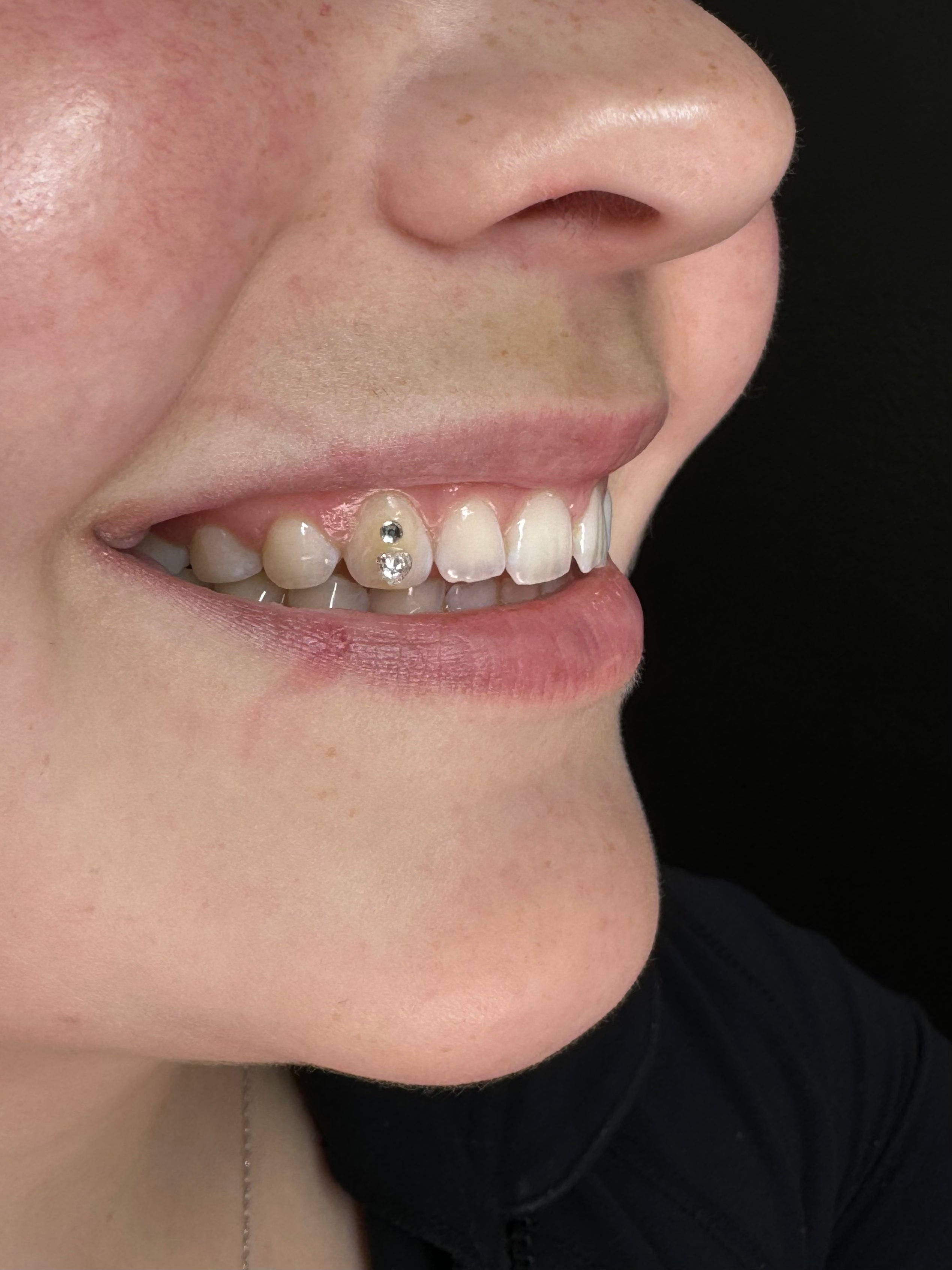 Tooth Gems 💎